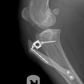 Tibial Tuberosity Advancement